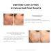 Murad Acne Control Kit: 30-Day Trial Breakout Skin Care with InvisiScar Resurfacing Treatment - Buy Online on GoSupps.com