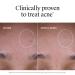 Neutrogena Evenly Clear Acne Exfoliant with Salicylic Acid & Mandelic Acid Multi-Acid Exfoliating Treatment Serum Visibly Fade the look of Post-Acne Marks for A Smooth Even Skin Tone 1 fl. oz - Buy Online on GoSupps.com