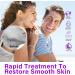 Azelaic Acid 12% Facial Serum Skin Hyaluronic Acid and Niacinamide Serum Redness Relief Fade - Buy Online on GoSupps.com