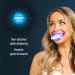 Smile Science Harley Street Professional Teeth Whitening Kit - Up to 8 Shades Whiter - Vegan, Rapid Results - Buy Online on GoSupps.com