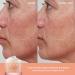 Alpyn Super Peptide & Ghostberry Moisturizer for Eczema Relief Barrier Repair & Wrinkle Reduction - Calm Redness & Irritation | 1.7 oz - Buy Online on GoSupps.com