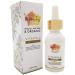 MyMiniJoy Vitamin E Oil for Skin  Face  Lip Gloss & Nails - 100% All Natural Pure & Organic - Cold Pressed - Prevents & Reduces the Appearance of Pregnancy Stretch Marks  Wrinkles  Scars  Dark Spots