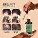 4 oz Pure Organic Batana Oil for Hair Growth & Skin Wellness | Nourishing Treatment from Honduras | Natural Shine & Moisturizing for Men & Women - Buy Online on GoSupps.com