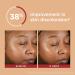 EltaMD UV Clear Deep Tint Sunscreen SPF 46 | Tinted Zinc Oxide Sunscreen for Sensitive & Acne-Prone Skin | Lightweight & Oil-Free | 1.7 oz - Buy Online on GoSupps.com