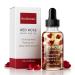 Brookstone Red Rose Multi-Use Essential Oil for Hair Face & Body - Deep Floral Rose Aroma Enriched with Rosehip Castor & Olive Oils (4 fl oz / 118 mL)