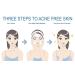 Effective Acne Treatment for Sensitive Skin | 80% Improvement in 4 Weeks | Pimple Cream & Face Toner for Acne Prone Skin - Buy Online on GoSupps.com