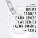 Bevel After Shave Balm for Men - Alcohol-Free Tea Tree Oil Reduces Ingrown Hairs & Bumps | 2 fl oz - Premium Beard Care - Buy Online on GoSupps.com