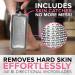 RUSTPROOF Callus Remover for Feet | XL Professional Pedicure Foot File & Spa Products | Effective Wet & Dry Dead Skin Scrubber - Non-Electric Foot Care Kit - Buy Online on GoSupps.com