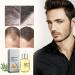 Hair Growth Essence Oil Natural Hair Density Essential Oil Ginger Hair Regrowth Essence Nourishes Repair Dry Damaged Hair - Buy Online on GoSupps.com