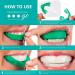 Opalescence Go - Prefilled Teeth Whitening Trays - 15% Hydrogen Peroxide - Mint - Buy Online on GoSupps.com
