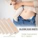 Medical Grade Silicone Scar Sheets Roll - Soft Easy-Tear & Reusable - Effective Scar Removal for All Skin Types - C-Section, Acne, Keloid, Surgery & Burn - Buy Online on GoSupps.com