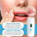 Virulite FDA Approved Cold Sore Treatment Device - Buy Online on GoSupps.com