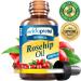 MYVIDAPURE Rosehip Oil Vitamin A, Vitamin C, Vitamen E for Wrinkles, Scars, Stretch Marks, Face, Body, Hair, Lip Care. (1 Fl Oz) 1 Fl Oz (Pack of 1) - Buy Online on GoSupps.com