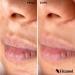 Vitamol Biosoft Sebum Regulating Cream against skin impurities acne pimples and blackheads - 40 ml - Buy Online on GoSupps.com