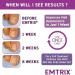Emtrix Nail Fungus Solution 10 ml - Buy Online on GoSupps.com