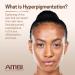 Ambi Even & Clear Fade Cream - Hyperpigmentation Treatment, Dark Spot Corrector with Niacinamide & Licorice Root Extract - 1 Fl Oz - Buy Online on GoSupps.com