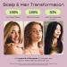 Jupiter Color Safe Dandruff Shampoo & Conditioner - Vegan, Sulfate-Free, 9.5 fl oz - Relieves Dry, Flaky, Itchy Scalp - Buy Online on GoSupps.com