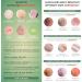 EMERGENCY SKIN TREATMENT BY BODY THERAPY Cosmetic adjuvant for the treatment of skin disorders in adults and children - Buy Online on GoSupps.com
