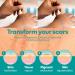 Medi Grade Silicone Scar Sheets - 80" Reusable Scar Tape for C-Section Keloid Burn & Acne Scars - Includes Hygienic Storage Case - Buy Online on GoSupps.com