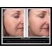 Kleem Organics Dark Spot Corrector Serum for Face, Hands & Neck - Bio-Formulated Age, Sun & Dark Spot Remover - Made in USA - Buy Online on GoSupps.com