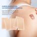 Puriderma Medical Silicone Scar Removal Sheets - Set of 5 | Fast & Effective on Keloid, Surgery, Burn, Acne, C-Section Scars - Buy Online on GoSupps.com