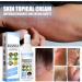 FEDVET Meellop Herbal Psoriasis Treatment Spray - Soothing & Moisturizing Eczema Relief - 2pcs - Buy Online on GoSupps.com