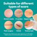 Medi Grade Silicone Scar Sheets - 80" Reusable Scar Tape for C-Section Keloid Burn & Acne Scars - Includes Hygienic Storage Case - Buy Online on GoSupps.com