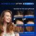 Intensive Hair Regrowth Treatment - 5% Active Complex | Natural Organic Formula for All Hair Types | 2 Fl OZ | Stop Hair Loss for Women & Men - Buy Online on GoSupps.com