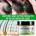 Raw Batana Oil for Hair Growth 100% Pure Batana Oil from Honduras Prevents Hair Loss Repairs Damage and Enhances Shine Promotes Thicker Healthier Hair for Men & Women 120g - Buy Online on GoSupps.com