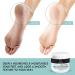 AVAMI 40% Urea Gel with Salicylic Acid, Tea Tree & Aloe Vera - Softens Dry Skin, Heals Cracked Heels & Calluses (Set) - Buy Online on GoSupps.com