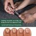 FVION Straight Blade Toenail Clipper - Professional Ingrown Toenail Tool for Thick Nails - Silver - Buy Online on GoSupps.com