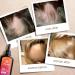 Hair Growth Serum - 5-in-1 Follicle Activator for Hair Loss Treatment, 1.7 oz - Buy Online on GoSupps.com