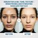 Renewa AgeDefy Niacinamide 5% Serum | Lightweight Hydrating Face Serum with Hyaluronic Acid and Antioxidants | Brightening Smoothing and Skin-Barrier Support for Radiant-Looking Skin 30mL - Buy Online on GoSupps.com