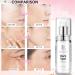 EIRENE BEAUTY Dark Spot Remover for Face and Body Dark Spot Corrector Serum - Advanced Treatment Sun Spot Age Spot Brown Spot Reduce for Women - 30mL - Buy Online on GoSupps.com
