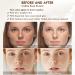 Dark Spot Remover for Face and Body Age Spot Remover for Face Dark Spot Corrector Freckle Remover Sunspots and Melasma with 2% Alpha Arbutin 5% Niacinamide 50 ml - Buy Online on GoSupps.com