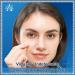 AnnaChoice Dissolvable Microdarts Acne Patches with Hyaluronate Salicylic Acid-Hydrocolloid - 18 Count - Buy Online on GoSupps.com