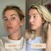 Averr Aglow Clarifying Hydration Dew - Natural Daily Face Moisturizer for Clear Skin - Buy Online on GoSupps.com
