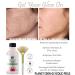 Planet Eden 70% Glycolic Acid Skin Peel Kit with Recovery Cream - Reduce Wrinkles, Age Spots & Sun Damage - Buy Online on GoSupps.com