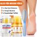 MrCuvaryas Urea Creme Foot Care Cream Urea Foot Cream Very dry feet for dry cracked feet heels elbows - Buy Online on GoSupps.com