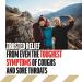Fisherman's Friend Sugar Free Honey-Lemon Cough Drops - 240 Menthol Lozenges (6 Packs of 40) | Cough Suppressant & Sore Throat Relief - Buy Online on GoSupps.com