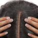 STUDIO LIMITED Lace Wig Grids & Knots Eraser Tape - Natural HD Cover, Silicone Melting & Non-Slip, Reusable & Breathable - Buy Online on GoSupps.com