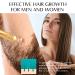 Ginger Hair Growth Serum | Prevent Hair Loss, Promote Thicker & Longer Hair | 1.7 Oz Bottle - Buy Online on GoSupps.com
