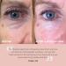 Vice Reversa Eye Rejuvenator - Hyaluronic Acid Under Eye Patches for Hydration & Brightening - MicroCrystal Skincare (12 Pairs) - Buy Online on GoSupps.com