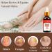 Fungal Nail Treatment for Toenails - Extra Strong 30ml Formula - Safely Reclaim Healthy Nails - Buy Online on GoSupps.com