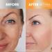 Retinol + Vitamin C Dark Spot Corrector Serum - Enhance Luminosity & Even Skin Tone 0.5 Oz | Spotless Radiance for Sun Damage & Dark Spots - Buy Online on GoSupps.com