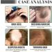 Hair Growth Serum Anti Hair Loss Hair Serum Rosemary Essential Oil With Ginseng And Castor Oil Extracts Repairs Hair Follicles Stronger Hair Hair Growth Oil for Women & Men 35ml - Buy Online on GoSupps.com