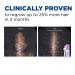 Women's Rogaine 2% Minoxidil Topical Solution - Hair Thinning and Loss Treatment for Regrowth - 3-Month Supply - Buy Online on GoSupps.com