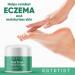 Tea Tree Oil Foot Cream for Dry Cracked Skin - Heel and Callus Treatment, Antifungal Formula for Athlete's Foot, Jock Itch, Eczema - Moisturizing Foot Treatment - Buy Online on GoSupps.com