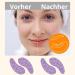 Amathings Reusable Silicone Eye Pads - Anti-Aging Anti-Wrinkle Care | 3 Pairs in High-Quality Storage Box - Buy Online on GoSupps.com