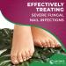 100ml All-Natural Anti Fungal Toenail Spray for Severe Toenail Fungus Treatment - Buy Online on GoSupps.com